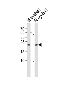 RCVRN Antibody (C-term)
