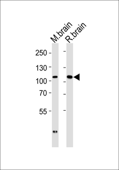 DLG2 Antibody (Center)