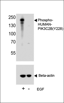 Phospho-HUMAN-PIK3C2B(Y228) Antibody