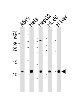 COX6B1 Antibody (N-term)