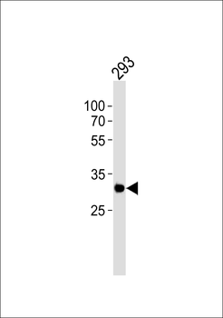 RPS6 Antibody (N-term)