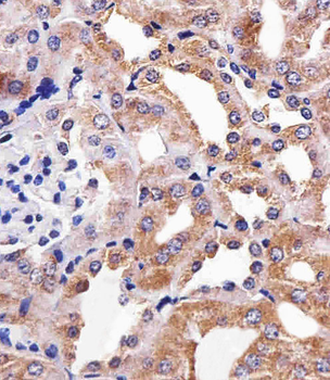 RPS6 Antibody (N-term)