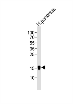 REG3A Antibody (C-term)