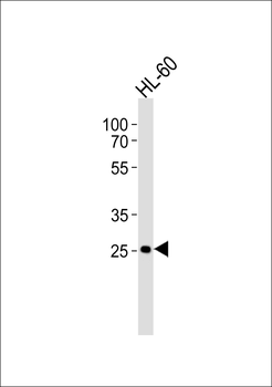 FCGR3B Antibody (N-term)
