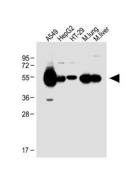 ALDH1A1 Antibody (Center)