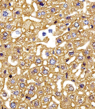 HBG2 Antibody (C-term)