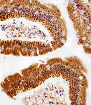 IL18 Antibody (C-term)