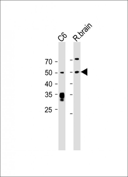 PAH Antibody (Center)