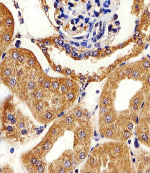 AK4 Antibody (Center)
