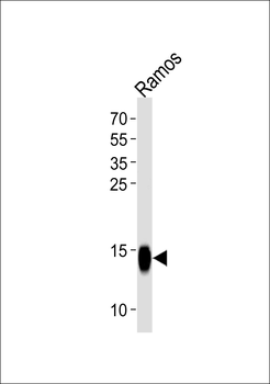 TCL1A Antibody (Center)