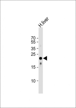 MMAB Antibody (Center)