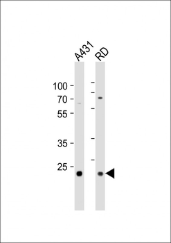 MMAB Antibody (Center)
