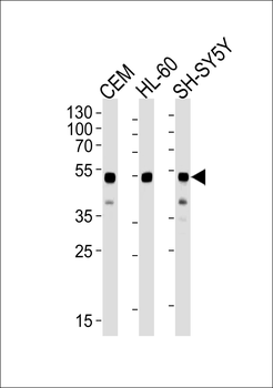 GATA3 Antibody (Center)