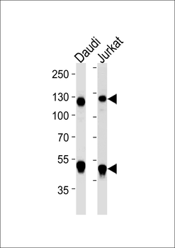 NFKB1 Antibody