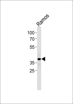 PHF11 Antibody (Center)