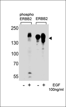 Phospho-ErbB2(Y1221) Antibody