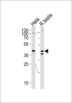 KHDRBS2 Antibody (C-term)