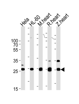 SDHB Antibody (Center)