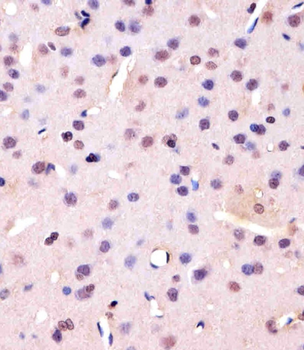 PCNA Antibody (C-term)
