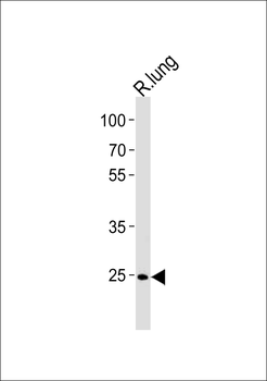 R Cdk4 Antibody (C-term)