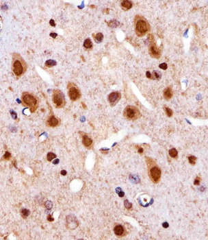 R Cdk4 Antibody (C-term)