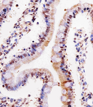 R Cdk4 Antibody (C-term)
