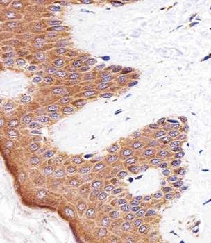 BLMH Antibody (Center)