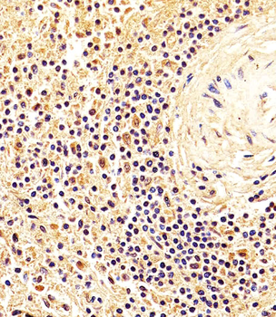 NME1 Antibody