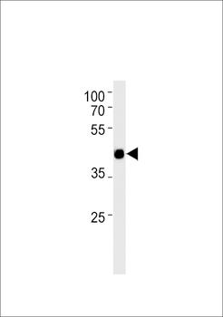 M Tcfap2d Antibody (C-term)