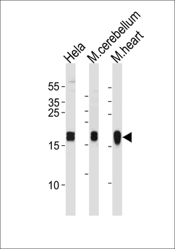 NDUFS7 Antibody (Center)