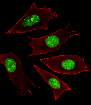 RNF166 Antibody (Center)