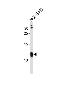 RPS21 Antibody (C-term)