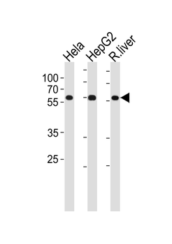 POLD2 Antibody (Center)