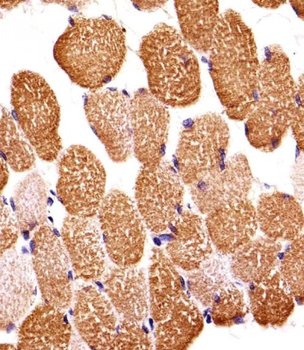 SIRPB1 Antibody (N-term)