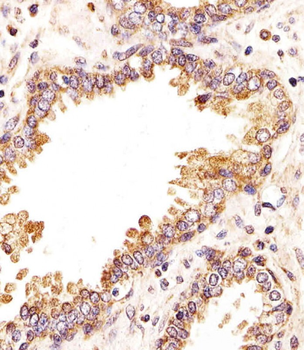 ZRSR2 Antibody (C-term)