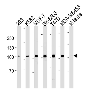 ACE2 Antibody