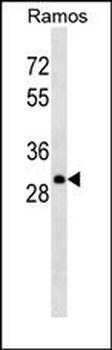 Lambda light chain Antibody