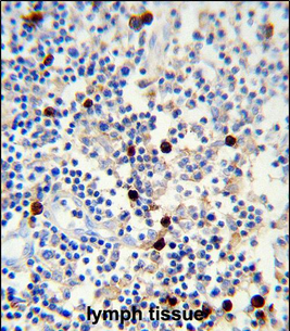 Lambda light chain Antibody