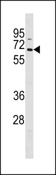 TCF7L1 Antibody (N-term)