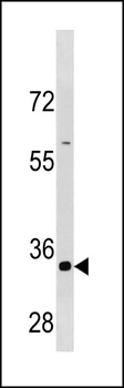 CCNB3 Antibody (C-term S1331/S1333)