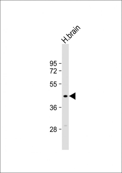 MTCH1 Antibody (Center)