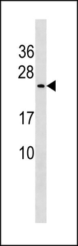 CUTA Antibody (C-term)