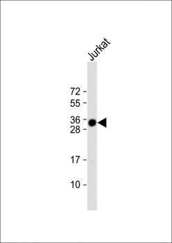 TMX1 Antibody (C-term)