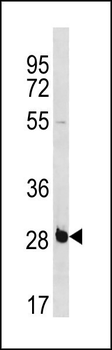 RBPMS Antibody (C-term)
