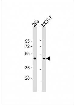 RARB Antibody (Center)