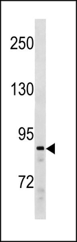 SUZ12 Antibody (C-term)