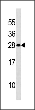 DENR Antibody (Center)