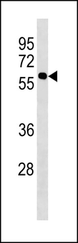 KISS1R Antibody (Center)