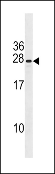 CXorf41 Antibody (C-term)
