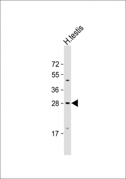 CXorf41 Antibody (C-term)